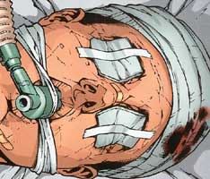 Jason Todd's head wound Jason Todd's head wound