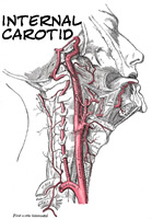 internal carotid artery