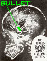 skull x-rays