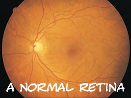 A healthy retina