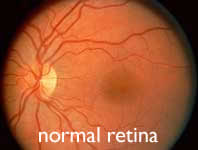 Human Retina
