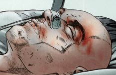 Speedball's shaven noggin, sans EEG electrodes