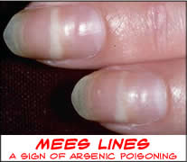 Mees lines