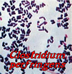 Clostridum perfringens