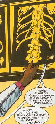 scene from Batman: Knightfall