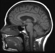 Sagittal section of the human skull