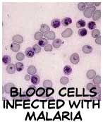 red blood cells infected with malaria