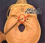 The Sella Turcica