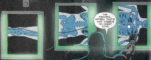 Hush's x-ray Hush's x-ray