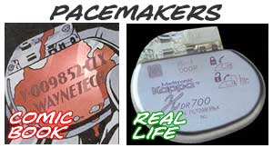 Pacemakers