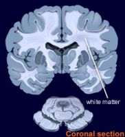 gray and white matter of the brain