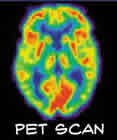 PET scan