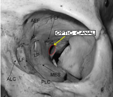 Optic canal