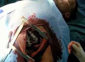 scene from Fringe episode 7