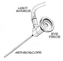 arthroscope