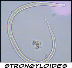 Strongyloides stercoralis
