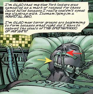 Iceman in the hospital